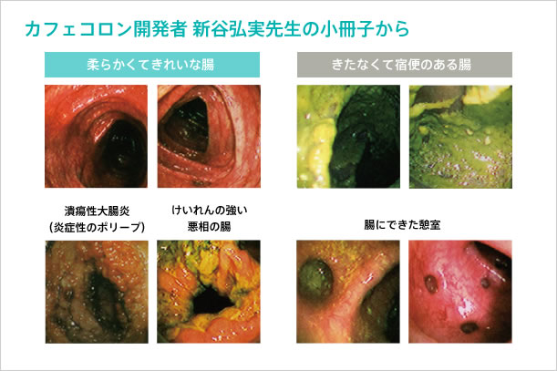 腸とお肌は表裏一体！「汚れた腸が病気を作る」